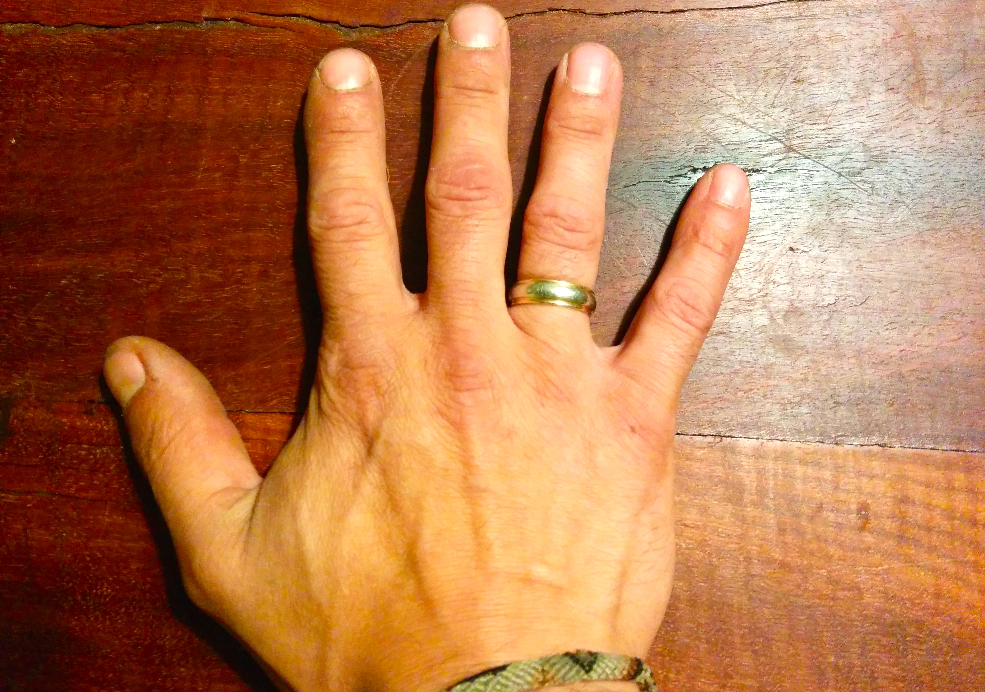 Кольцо на пальцах кулака